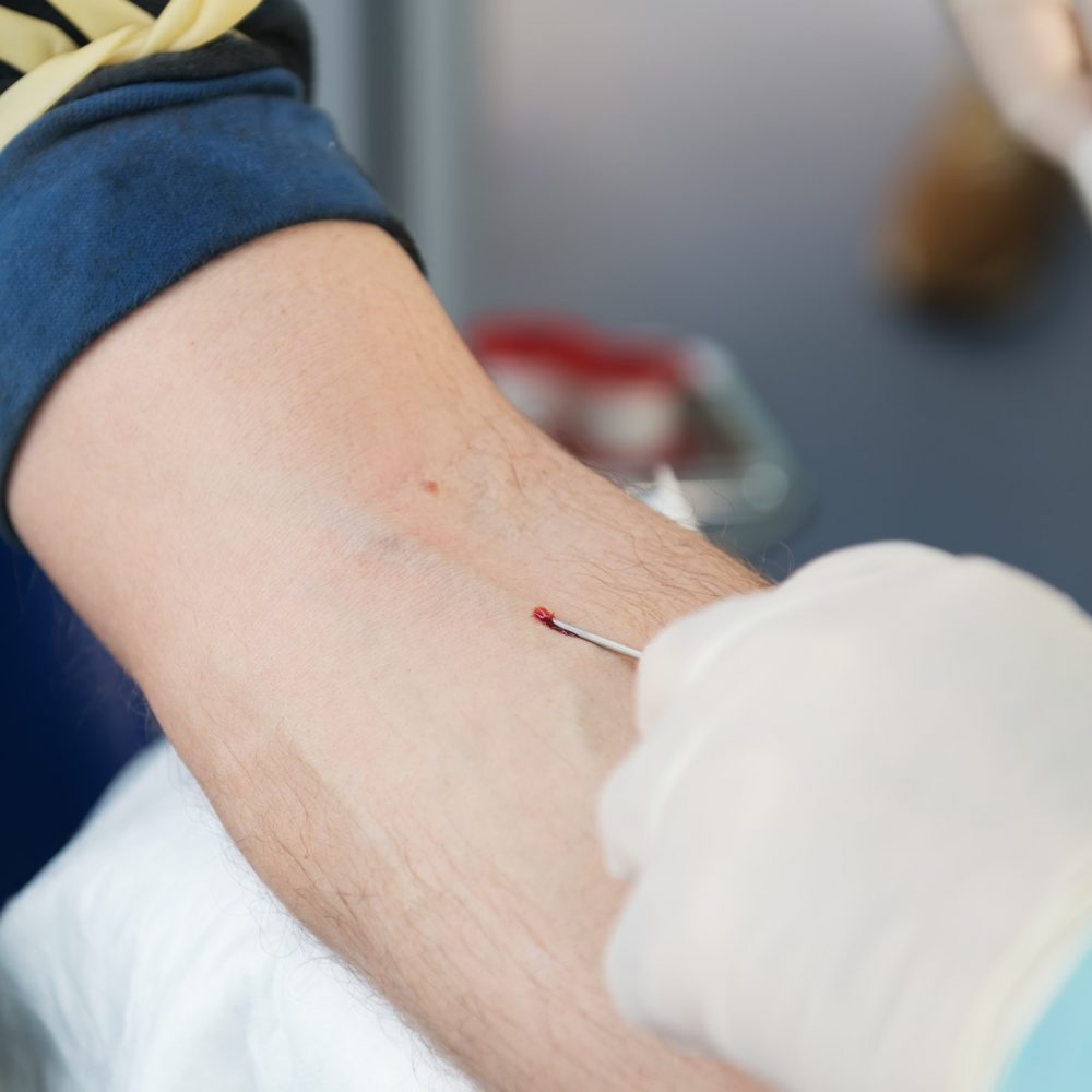 Associação pede que Anvisa cumpra decisão que permite doação de sangue por homossexuais