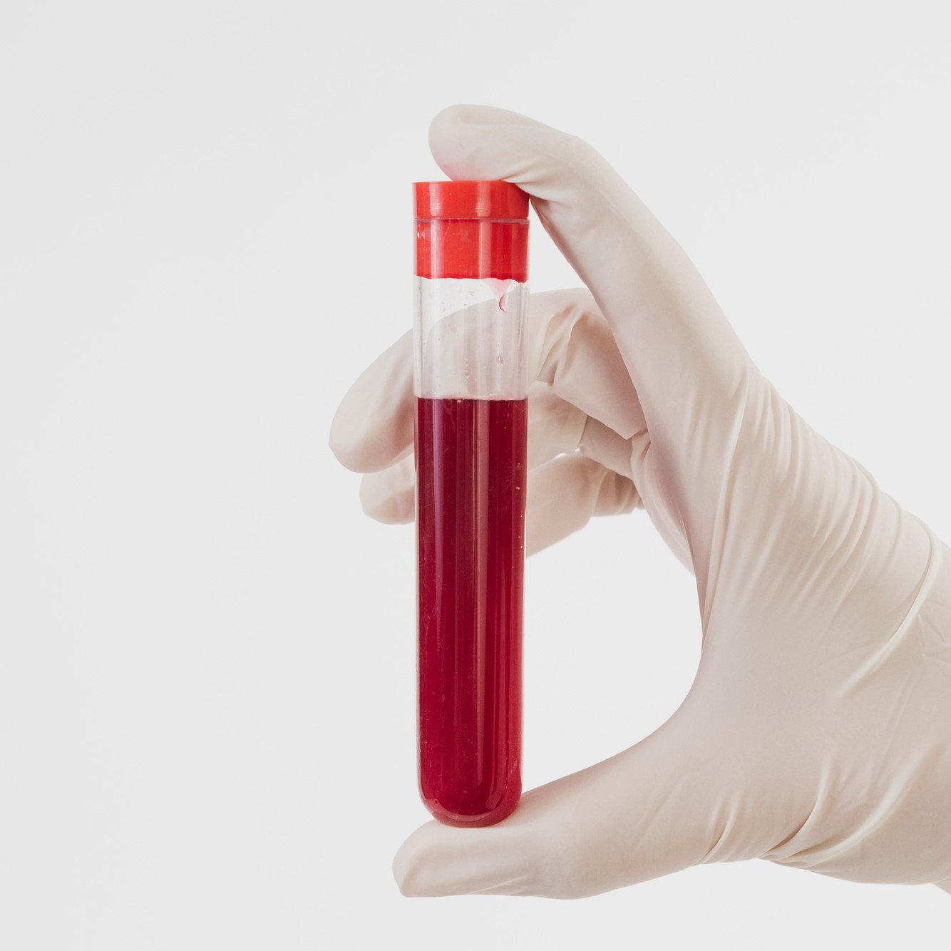 Justiça autoriza transfusão de sangue independentemente de motivo religioso